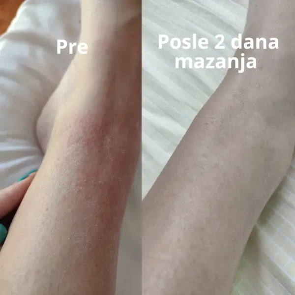 Mazalica pre i posle