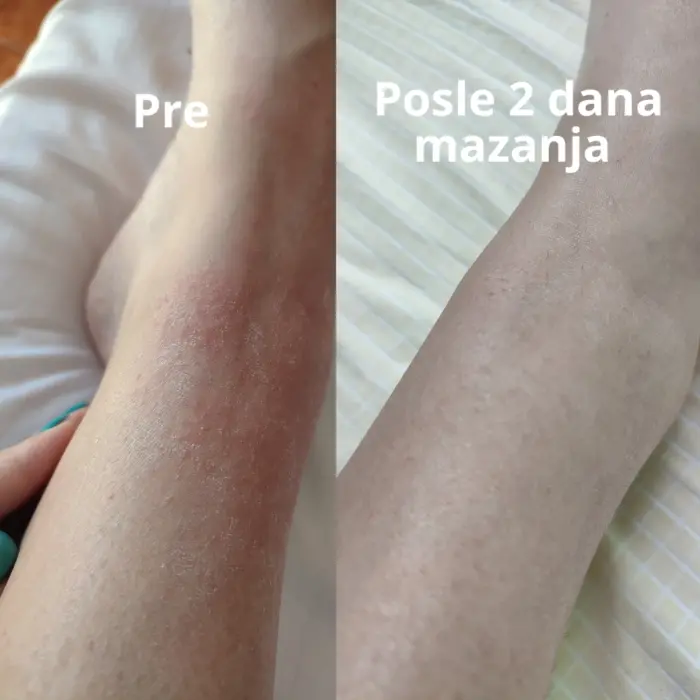 Mazalica pre i posle